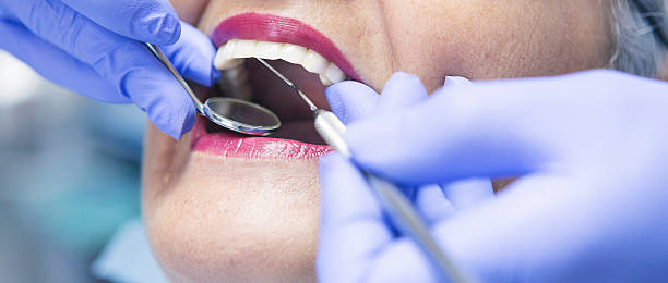 Best Broken or Chipped Tooth Repair in Elizabethtown, PA